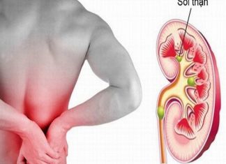 Triệu chứng bệnh sỏi bàng quang và cách chữa trị Sỏi bàng quang là gì?