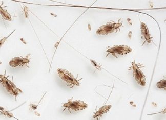 Mơ thấy con chấy điềm báo gì và những con số liên quan mo-thay-con-chay