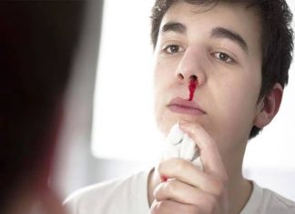 Nằm mơ thấy chảy máu cam đánh con gì? Đánh số mấy?