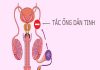 Tắc ống dẫn tinh là gì? Nguyên nhân, triệu chứng của bệnh Tắc ống dẫn tinh là gì?