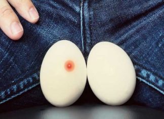 Nổi mụn ở tinh hoàn là triệu chứng như thế nào?