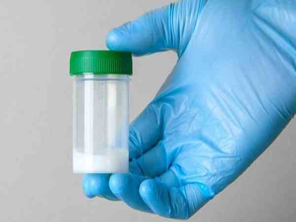 Tinh trùng loãng hay đặc có ảnh hưởng đến khả năng thụ thai?