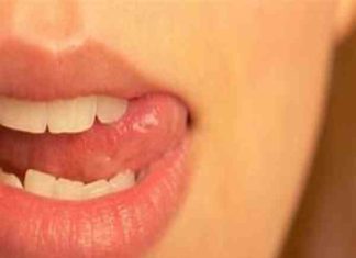 Các bệnh gì dễ lây qua quan hệ bằng miệng bạn cần biết? quan hệ bằng miệng dễ lây bệnh gì