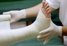 Nằm mơ thấy gãy chân là điềm gì, con gì giải đen?