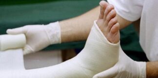 Nằm mơ thấy gãy chân là điềm gì, con gì giải đen?