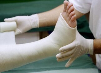 Nằm mơ thấy gãy chân là điềm gì, con gì giải đen? Nằm mơ thấy gãy chân là điềm gì, con gì giải đen?