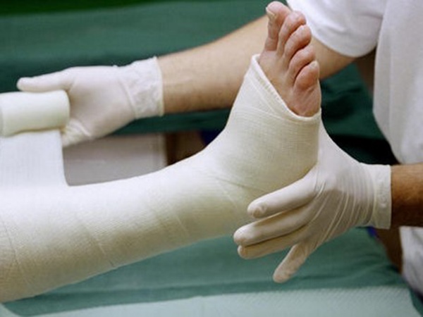 Nằm mơ thấy gãy chân là điềm gì, con gì giải đen?