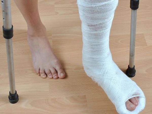 Nằm mơ thấy gãy chân là điềm gì, con gì giải đen?